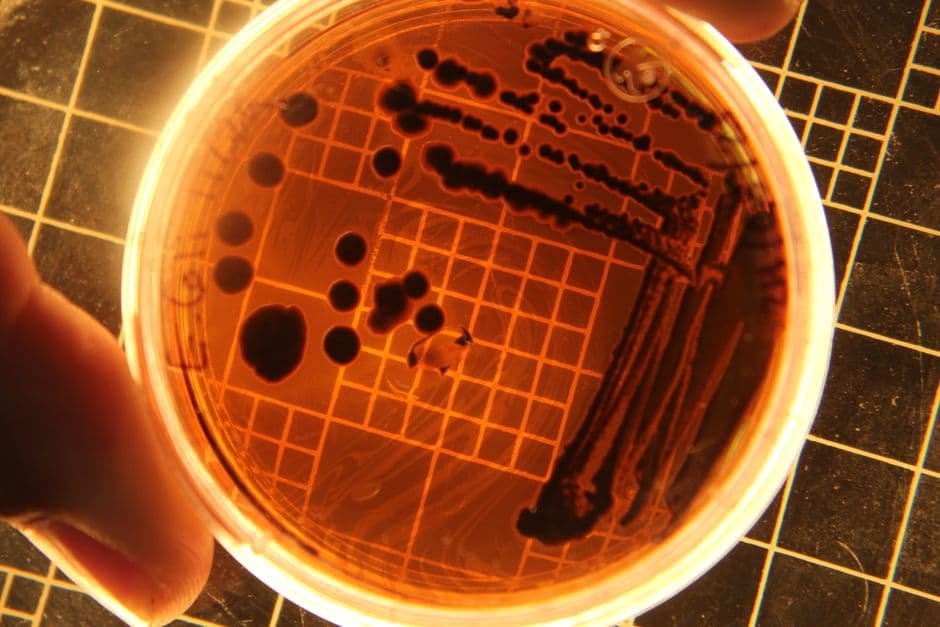 Imagem ilustrativa: Metabolismo como alvo: como potencializar antibióticos contra Staphylococcus aureus resistente